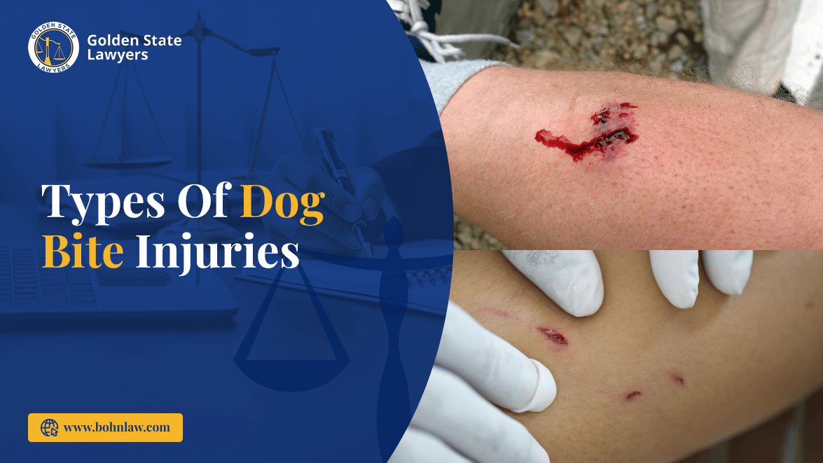 Types of Dog Bite Injuries and Their Treatment